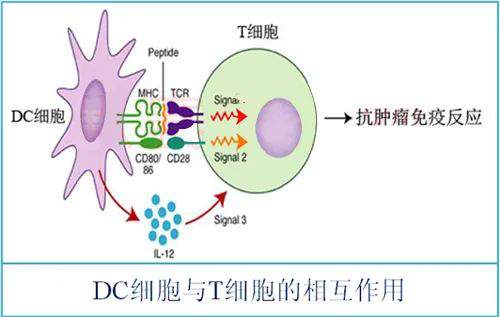 刘向善|树突细胞(dc)免疫疗法治疗各种实体瘤取得确切疗效!