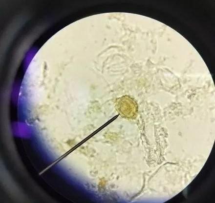 蛔虫到底有多可怕?