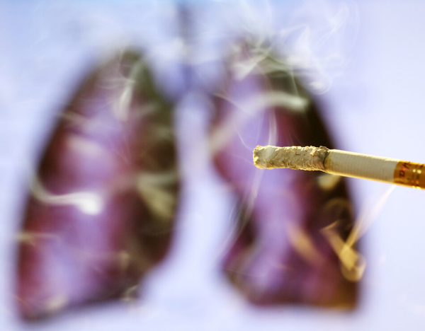 32岁男子,一天两包烟,不幸患上肺癌,3个月后遗憾离世
