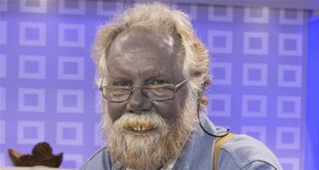 罕见的蓝种人,皮肤血液都是蓝色,为躲争议百年来只露了一次面!