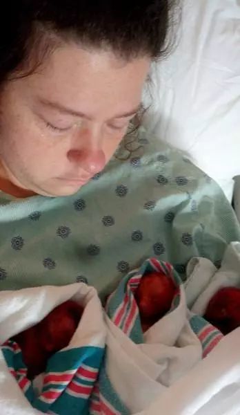 三胞胎胎死腹中,伤心妈妈拍照传上网络,被指责"婴儿凶手" !