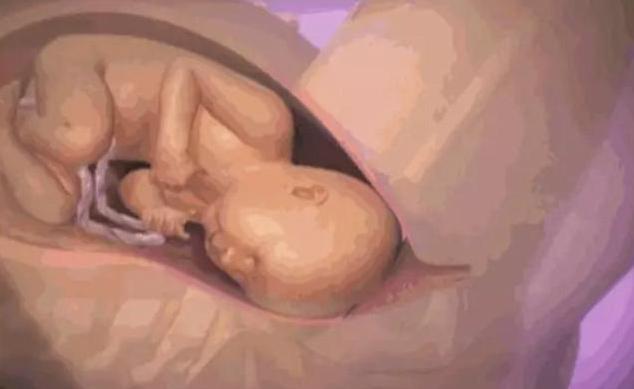 那么大的胎儿是怎么从产道出来的?三张图让你看完整个