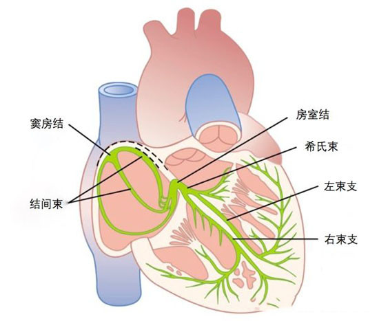 心脏的传导阻滞有好多种,这位患者是房室传导阻滞,安装的是双腔起搏