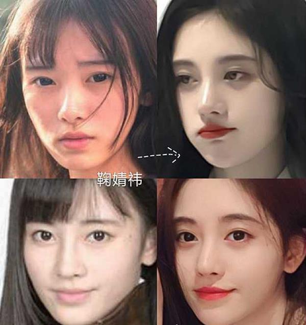 鞠婧祎出现整容后遗症借来的美迟早要还