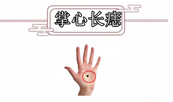 身上5颗"暗财"痣,藏而不露,一个升官,一个生财,福禄寿