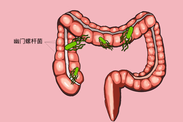 人口内细菌_细菌卡通图片(2)