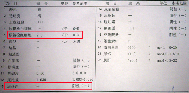 病变再进一步恶化,出现肾功能衰竭,即肌酐清除率下降,血清肌酐增高,并