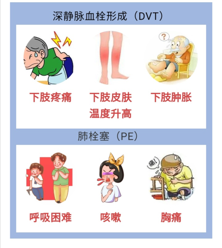 vte有哪些常见症状?