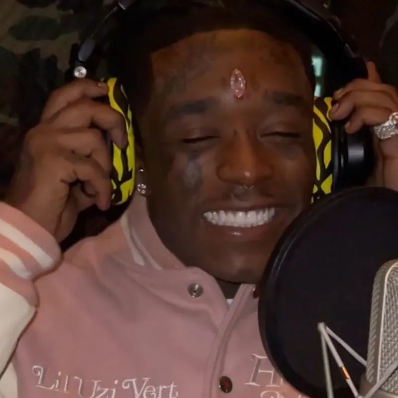 lil uzi vert在额头上植入1.5亿奢华粉钻!随意取下还会死!