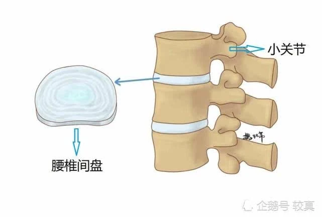 腰椎解剖示意图