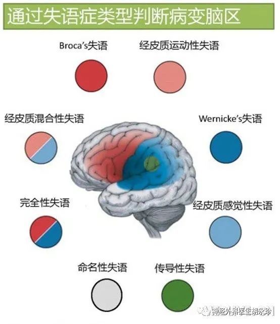 卒中后失语症