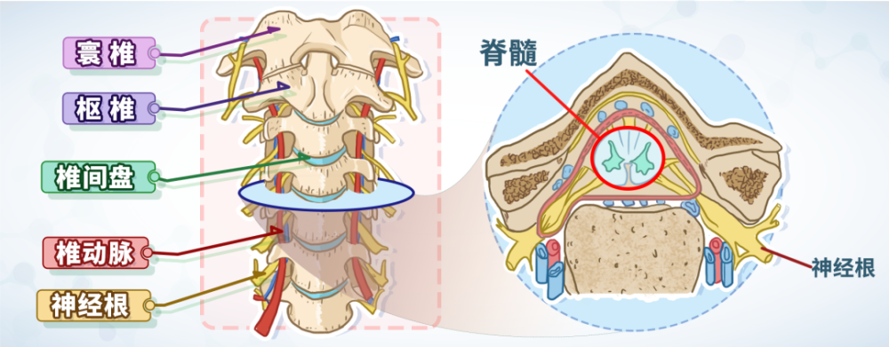 颈椎有七节,第一节颈椎称为寰椎,第二节颈椎称为枢椎,之后依次是第三