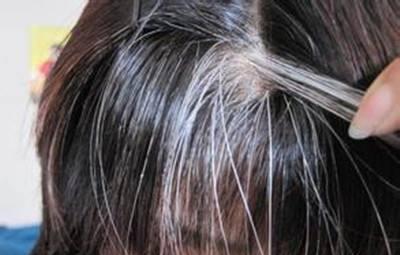 为什么头上白头发越来越多,是不是身体里缺什么了?