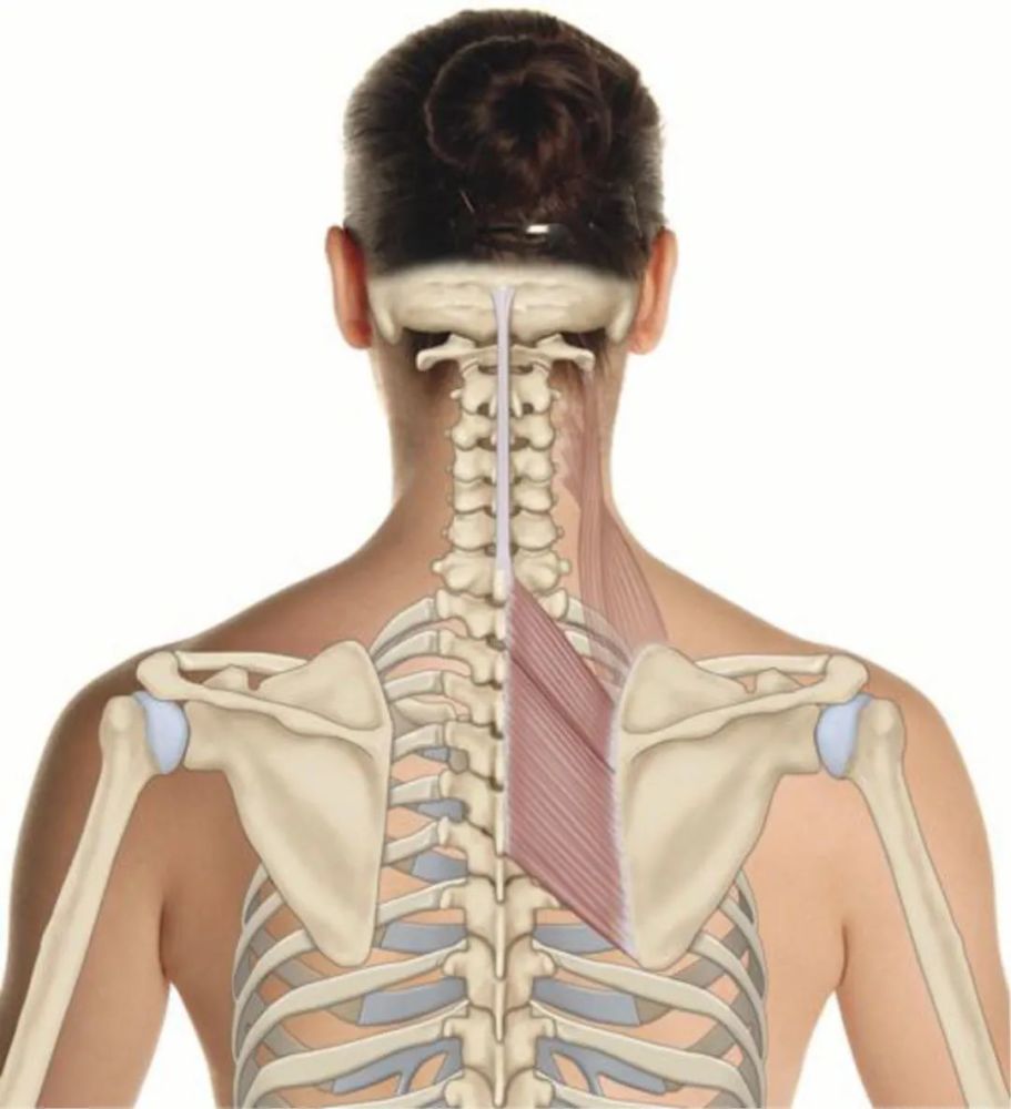菱形肌——肩胛骨疼痛的主要原因