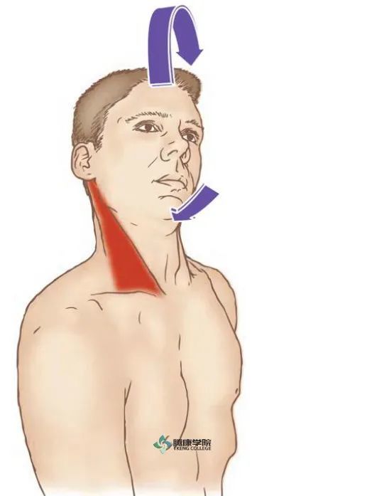 头面部疼痛关键肌—胸锁乳突肌