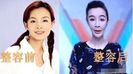 曾是央视美女主持,因整容吓坏观众,网友:看见她就关电视