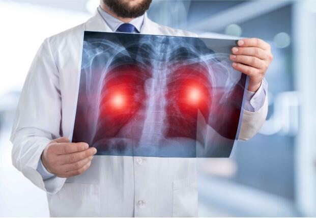 肺癌早期的4个征兆,多数人都忽视了,希望你早了解!