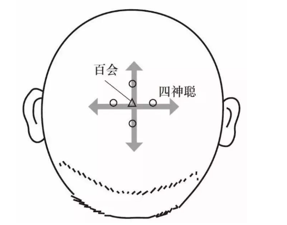 二,四神聪 中医认为,脑为元神之府,主灵性记忆,长时间的脑力活动