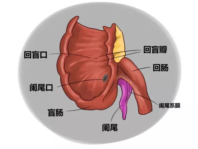 妊娠合并急性阑尾炎你被惊到了吗