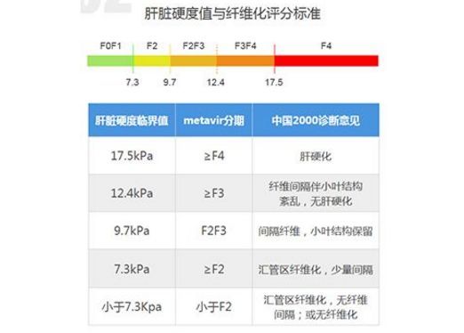 种瞬时弹性成像技术测量肝脏硬度的方法来点评肝纤维化及肝硬化的程度