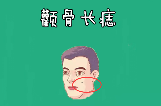 身上5颗"黄金"痣,一个生财,一个升官,有权有势,儿女双全!