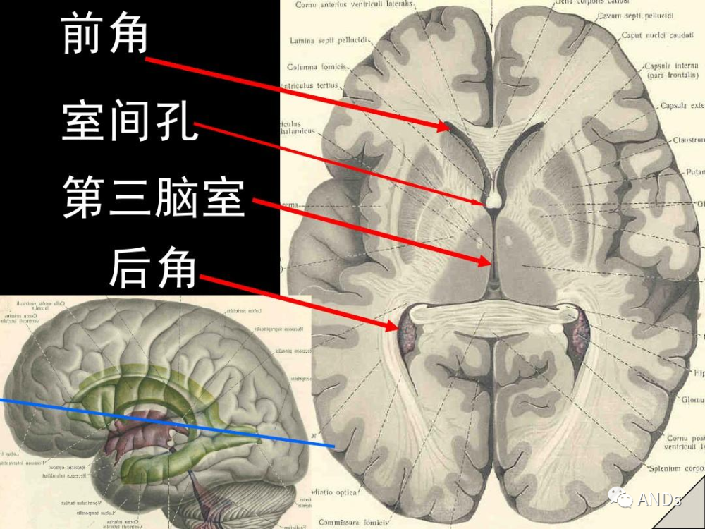 高清解剖:脑室/脑池/脑膜