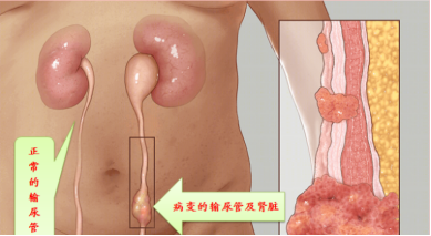 算人口发病_人口普查(2)