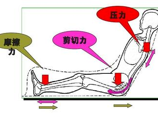 平卧位时抬高床头一般不应高于30度; ·半卧位或坐位时间每次缩短