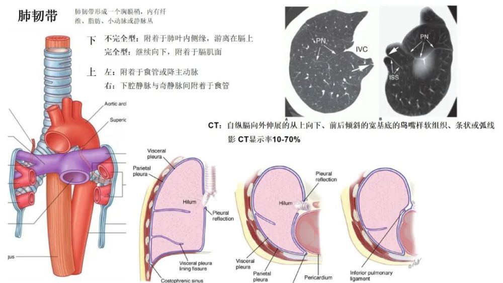 一网打尽肺叶间附属裂