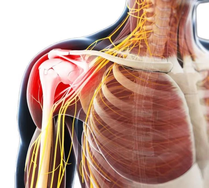 肩膀疼痛的关键肌——三角肌
