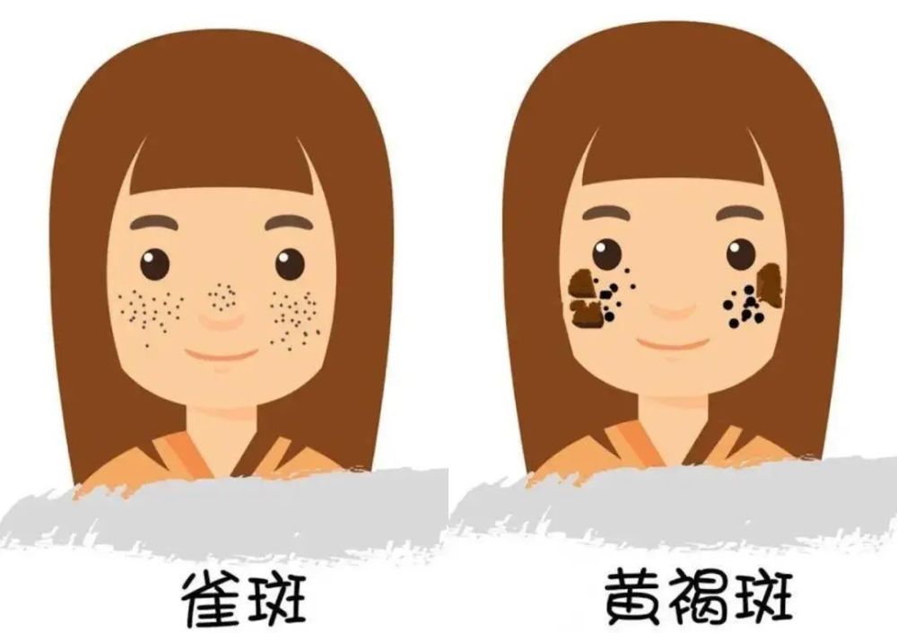 形成原因:内分泌失调,精神压力大等也有可能会形成.