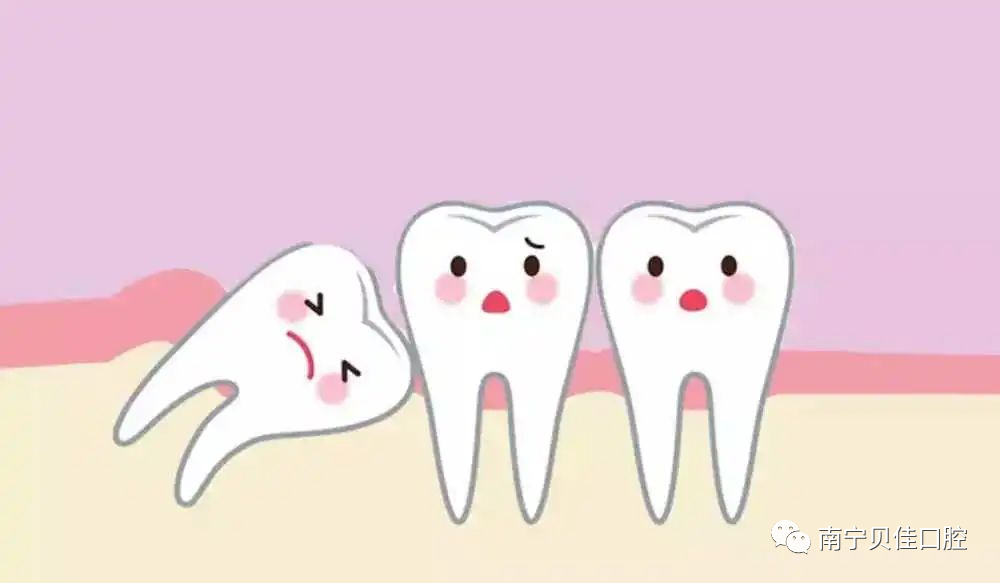 牙科小知识:拔完智齿,脸却肿成猪头?其实这不是医生的