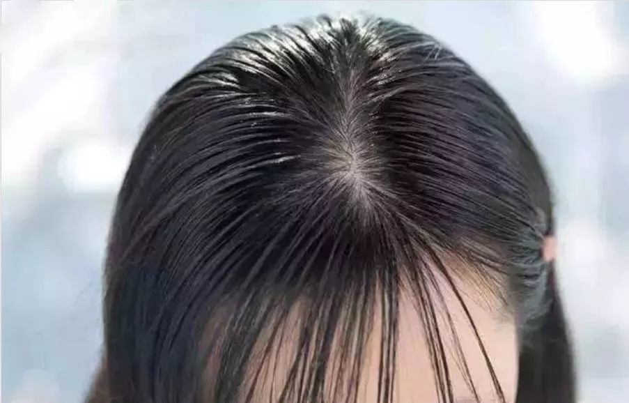 发根已经出油,发梢还很干燥?