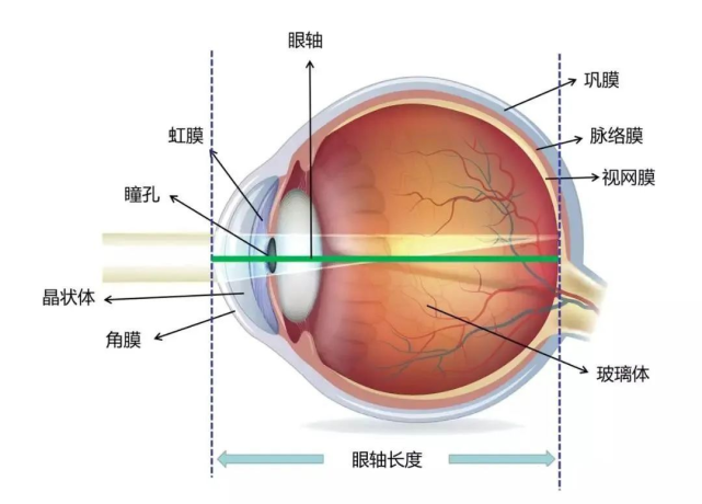 眼轴是什么?为什么说眼轴长度和近视有关?