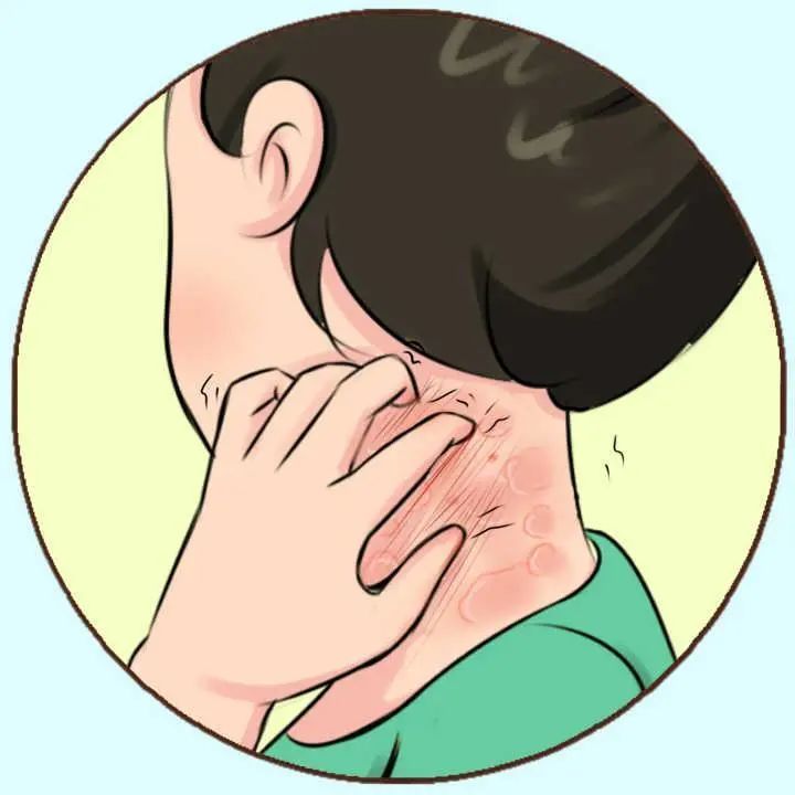 痒 腾讯网