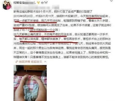 红粉宝宝整容记:16岁开始,次数达200次,金额达400多万