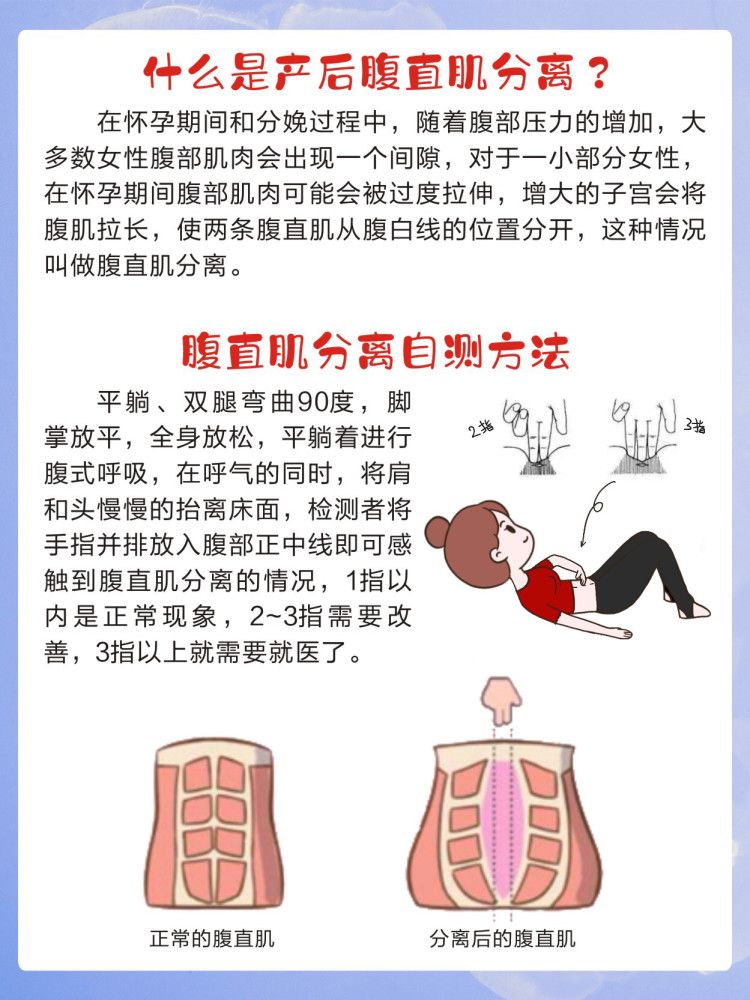 腹直肌盆底肌恢复全攻略45天重拾少女感