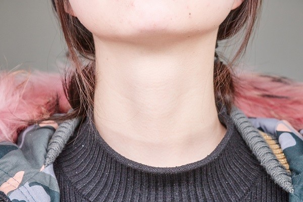 女性甲状腺癌的发病率高是男性的3倍?为何甲状腺癌偏爱女性?