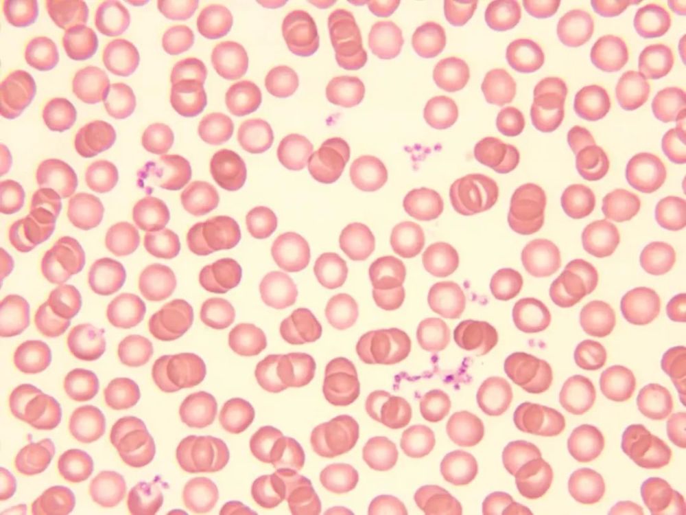 图为正常红细胞