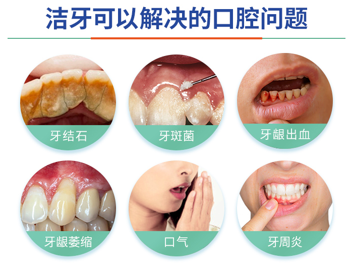 古人的洁牙方式这么牛?