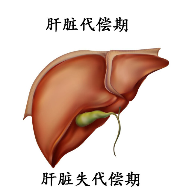 二,说肝脏很顽强,不止是代偿期,而且代偿行为非常强大