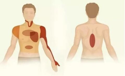 这个地方疼真不是骨科病,心跳随时可能停!45岁后互相提醒