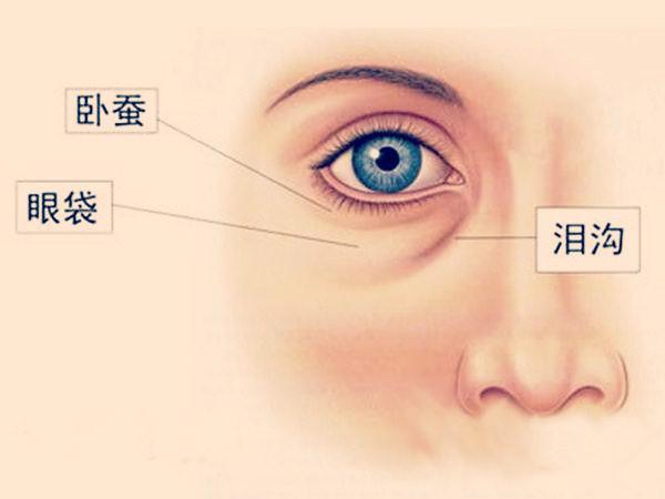 啥眼袋卧蚕泪沟黑眼圈1招教你快速区分重拾靓丽双眼