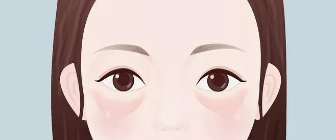 眼袋=卧蚕=泪沟=黑眼圈?1招教你快速区分,重拾靓丽双眼