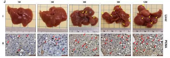 实验中小鼠的肝脏变化