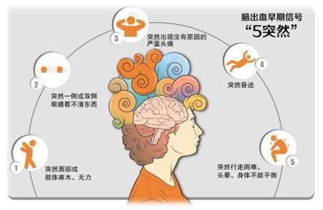 脑出血后遗症能完全恢复吗?