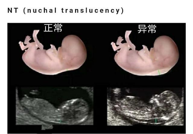 怀孕3个月男女胎儿差异大:4件小事孕妇要常放在心上,尤其第1件
