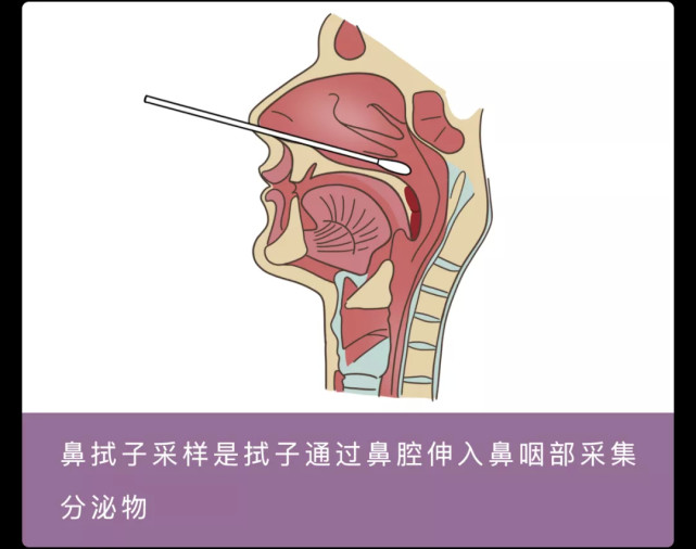 核酸检测为啥要戳菊花啊!