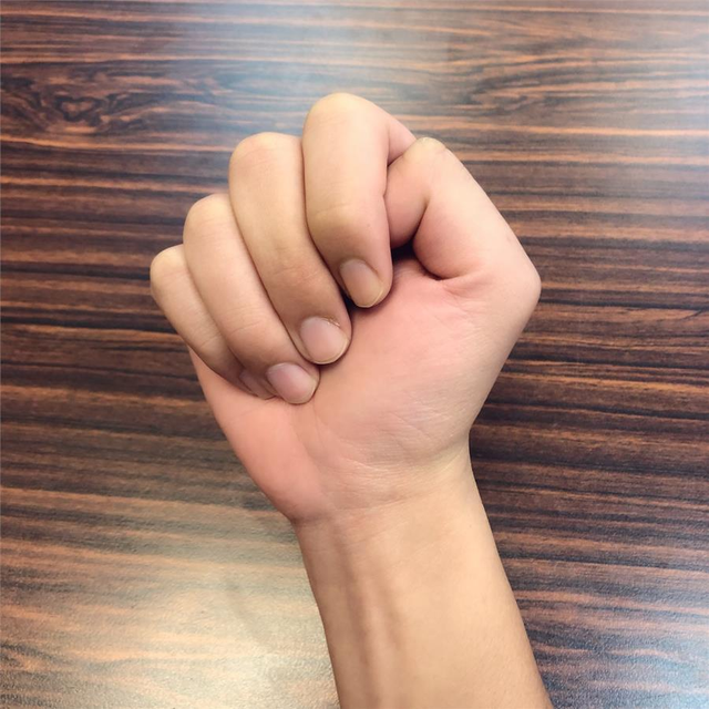 提醒:想知道血管堵不堵,握紧拳头30秒,一测便知