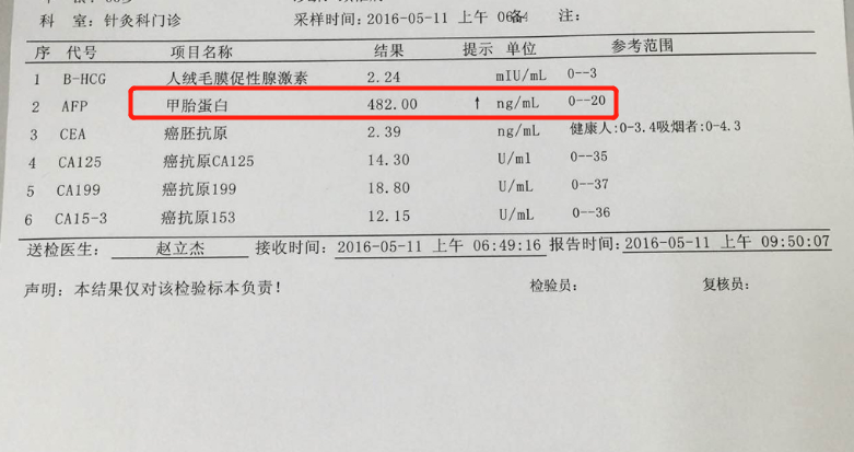 经检查,王先生的甲胎蛋白高达482ug/l,确诊肝癌.